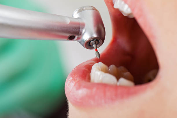 Best Emergency Broken Tooth Repair in Deatsville, AL